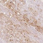 AQPEP Antibody in Immunohistochemistry (IHC)