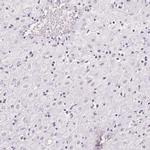 AQPEP Antibody in Immunohistochemistry (IHC)