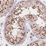 RAD21L1 Antibody in Immunohistochemistry (IHC)