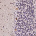 AGPAT4 Antibody in Immunohistochemistry (Paraffin) (IHC (P))