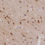 AGPAT4 Antibody in Immunohistochemistry (Paraffin) (IHC (P))