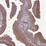 AGPAT4 Antibody in Immunohistochemistry (Paraffin) (IHC (P))