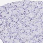 BAG6 Antibody in Immunohistochemistry (Paraffin) (IHC (P))