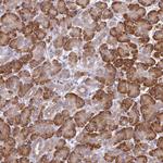 SEC63 Antibody in Immunohistochemistry (Paraffin) (IHC (P))