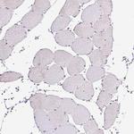 SEC63 Antibody in Immunohistochemistry (Paraffin) (IHC (P))