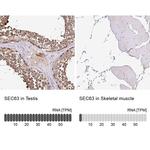 SEC63 Antibody in Immunohistochemistry (IHC)