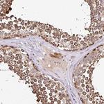 SEC63 Antibody in Immunohistochemistry (IHC)