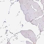 SEC63 Antibody in Immunohistochemistry (IHC)