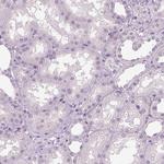 OTUD6A Antibody in Immunohistochemistry (Paraffin) (IHC (P))