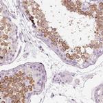 OTUD6A Antibody in Immunohistochemistry (IHC)