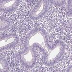 OTUD6A Antibody in Immunohistochemistry (IHC)