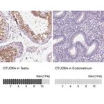 OTUD6A Antibody