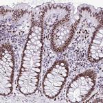 HMGB2 Antibody in Immunohistochemistry (Paraffin) (IHC (P))