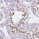 HMGB2 Antibody in Immunohistochemistry (Paraffin) (IHC (P))