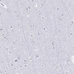 HMGB2 Antibody in Immunohistochemistry (IHC)