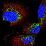 AGK Antibody in Immunocytochemistry (ICC/IF)