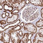 AGK Antibody in Immunohistochemistry (Paraffin) (IHC (P))