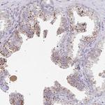 MANBA Antibody in Immunohistochemistry (Paraffin) (IHC (P))