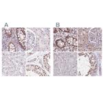 ZC3H14 Antibody in Immunohistochemistry (IHC)