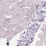 ZC3H14 Antibody in Immunohistochemistry (IHC)