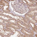 TRIAP1 Antibody in Immunohistochemistry (Paraffin) (IHC (P))