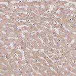 TRIAP1 Antibody in Immunohistochemistry (Paraffin) (IHC (P))