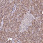 TRIAP1 Antibody in Immunohistochemistry (Paraffin) (IHC (P))