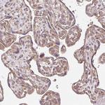 TRIAP1 Antibody in Immunohistochemistry (Paraffin) (IHC (P))