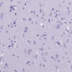 MEOX2 Antibody in Immunohistochemistry (Paraffin) (IHC (P))