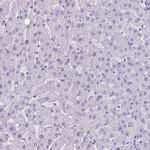 MEOX2 Antibody in Immunohistochemistry (Paraffin) (IHC (P))