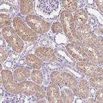 CTU1 Antibody in Immunohistochemistry (Paraffin) (IHC (P))