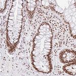 FUSIP1 Antibody in Immunohistochemistry (Paraffin) (IHC (P))