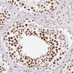 FUSIP1 Antibody in Immunohistochemistry (Paraffin) (IHC (P))