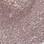 FUSIP1 Antibody in Immunohistochemistry (Paraffin) (IHC (P))