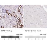 BSND Antibody in Immunohistochemistry (IHC)