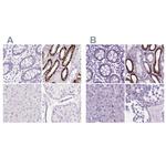 BSND Antibody in Immunohistochemistry (IHC)