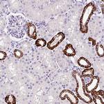 BSND Antibody in Immunohistochemistry (IHC)