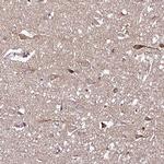 DPAGT1 Antibody in Immunohistochemistry (Paraffin) (IHC (P))