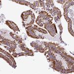 DPAGT1 Antibody in Immunohistochemistry (Paraffin) (IHC (P))