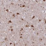 AKAP5 Antibody in Immunohistochemistry (Paraffin) (IHC (P))