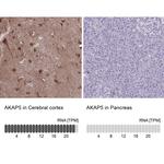 AKAP5 Antibody in Immunohistochemistry (IHC)