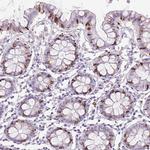 FGFBP3 Antibody in Immunohistochemistry (Paraffin) (IHC (P))