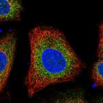 VKORC1L1 Antibody in Immunocytochemistry (ICC/IF)