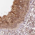 ZNF580 Antibody in Immunohistochemistry (Paraffin) (IHC (P))