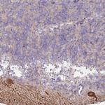 MTMR14 Antibody in Immunohistochemistry (Paraffin) (IHC (P))