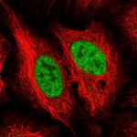 NEIL1 Antibody in Immunocytochemistry (ICC/IF)