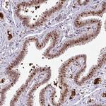 NEIL1 Antibody in Immunohistochemistry (Paraffin) (IHC (P))