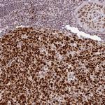 NEIL1 Antibody in Immunohistochemistry (Paraffin) (IHC (P))