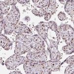 NEIL1 Antibody in Immunohistochemistry (Paraffin) (IHC (P))