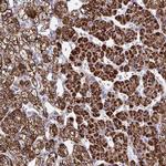 BCAT2 Antibody in Immunohistochemistry (IHC)